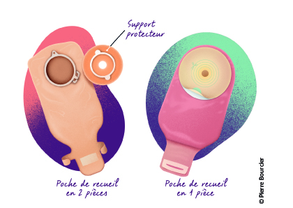 Les différents types d'appareillage ©Pierre Bourcier