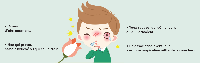 crises d'éternuement, nez qui gratte parfois bouché ou qui coule clair, yeux rouges qui démangent ou qui larmoient, en association éventuelle avec une respiration sifflante ou une toux
