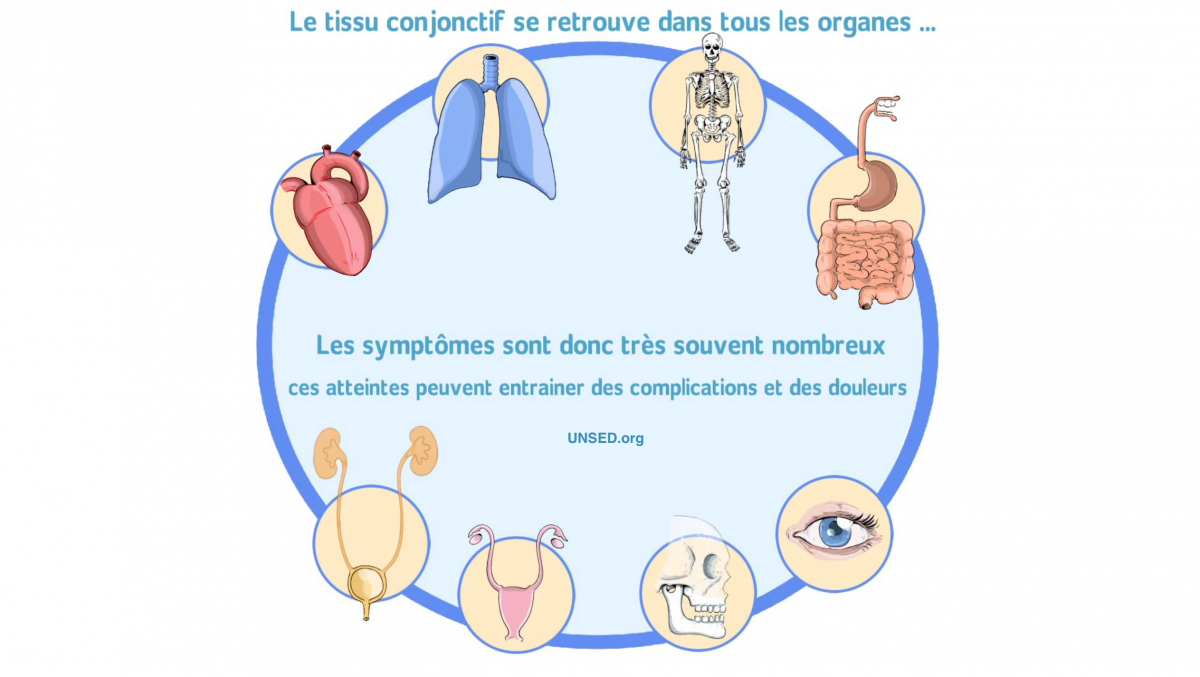 Les syndromes d’EhlersDanlos (SED) Santé.fr