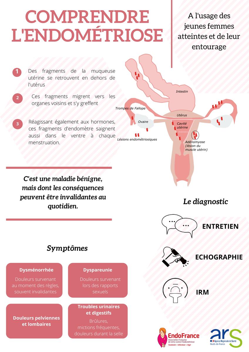 Comprendre l'endométriose | Santé.fr