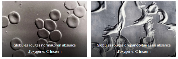hemoglobines.png