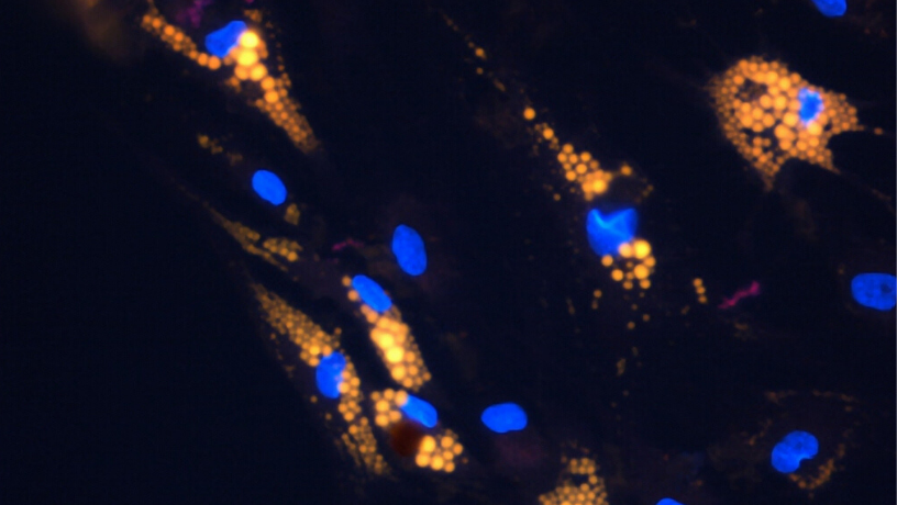 Adipocytes en culture obtenus à partir de cellules souches mésenchymateuses (gouttelettes lipidiques en jaune, noyaux en bleu). © Inserm, F. Blanchard