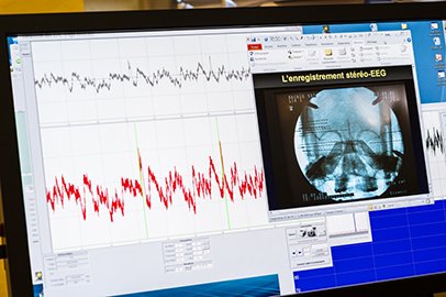inserm-55258-eegepilepsie-dlargeur.jpg