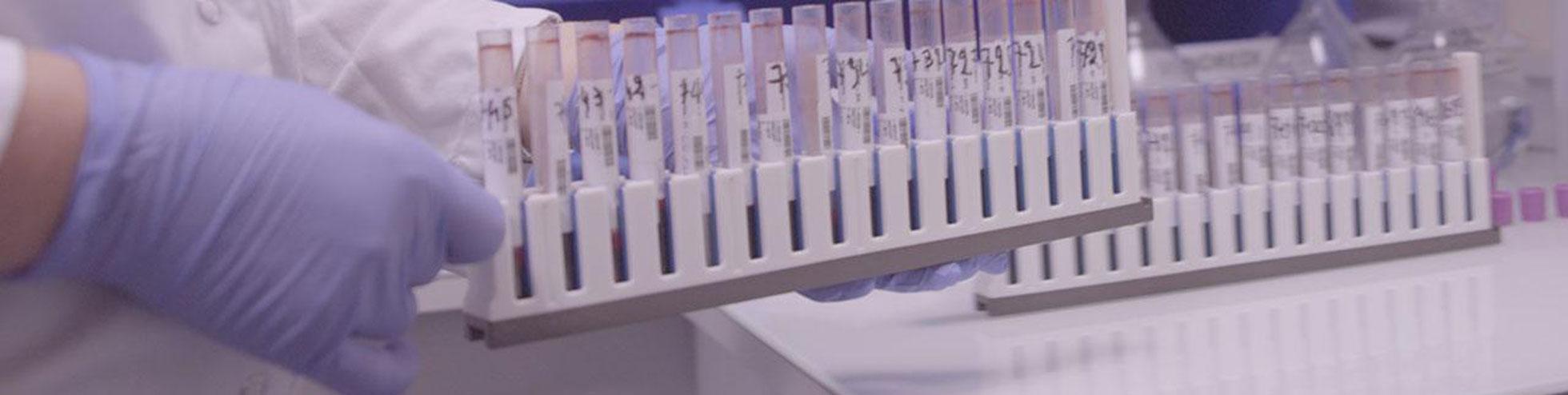 Tout savoir sur les infections ostéo-articulaires complexes